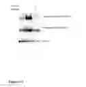 Fig. 16 - Using impedance-based cell response profiling to identify putative inhibitors for oncogene addicted targets or pathways