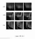 Fig. 17 - Adaptive local window-based methods for characterizing features of interest in digital images and systems for practicing same