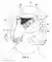 Fig. 06 - Hair Capturing Assembly