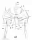 Fig. 03 - Sweat management pad for protective helmets