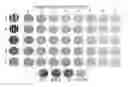 Fig. 01 - System and method for the rapid measurement of the visual contrast sensitivity function