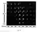 Fig. 07 - System and method for non-contrast myocardium diagnosis support