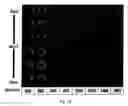 Fig. 08 - System and method for non-contrast myocardium diagnosis support