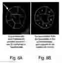 Fig. 09 - System and method for non-contrast myocardium diagnosis support
