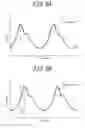 Fig. 06 - BLOOD PRESSURE ESTIMATION APPARATUS, SPHYGMOMANOMETER, BLOOD PRESSURE ESTIMATION SYSTEM, AND BLOOD PRESSURE ESTIMATION METHOD