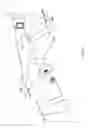 Fig. 08 - Wireless intracranial pressure monitors