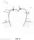 Fig. 07 - System for measuring teeth movement and contact pressure