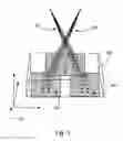 Fig. 04 - SYSTEMS AND METHODS FOR MEASURING AND ASSESSING SPINE INSTABILITY