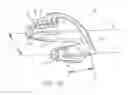 Fig. 06 - NASAL INSERT HAVING ONE OR MORE SENSORS