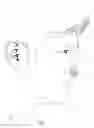 Fig. 17 - NASAL INSERT HAVING ONE OR MORE SENSORS