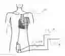 Fig. 01 - Apparatus for recording and analysing a surface electrocardiogram (ECG) for distinguishing a physiological signal from noise