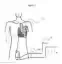 Fig. 03 - Apparatus for recording and analysing a surface electrocardiogram (ECG) for distinguishing a physiological signal from noise