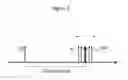 Fig. 10 - Apparatus for recording and analysing a surface electrocardiogram (ECG) for distinguishing a physiological signal from noise