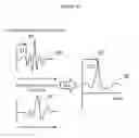 Fig. 14 - Apparatus for recording and analysing a surface electrocardiogram (ECG) for distinguishing a physiological signal from noise