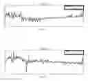 Fig. 10 - Method and apparatus for heart rate and respiration rate estimation using low power sensor