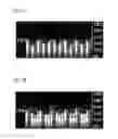 Fig. 05 - Stimulated echo sequence scanning magnetic resonance method and apparatus for heart diffusion imaging