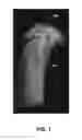 Fig. 02 - Systems and methods for characterizing a central axis of a bone from a 3D anatomical image