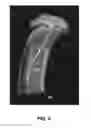 Fig. 06 - Systems and methods for characterizing a central axis of a bone from a 3D anatomical image