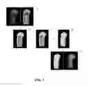 Fig. 08 - Systems and methods for characterizing a central axis of a bone from a 3D anatomical image