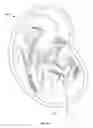 Fig. 17 - ULTRASONIC FETAL IMAGING WITH SHEAR WAVES