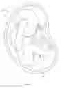 Fig. 18 - ULTRASONIC FETAL IMAGING WITH SHEAR WAVES