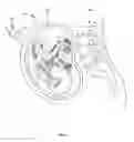 Fig. 05 - IMAGE PROCESSING FOR AN ULTRASONIC FETAL IMAGING DEVICE