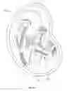 Fig. 17 - IMAGE PROCESSING FOR AN ULTRASONIC FETAL IMAGING DEVICE