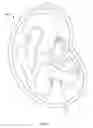 Fig. 18 - IMAGE PROCESSING FOR AN ULTRASONIC FETAL IMAGING DEVICE