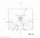 Fig. 02 - Multiple spinal surgical pathways systems and methods