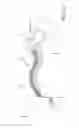 Fig. 04 - Multiple spinal surgical pathways systems and methods