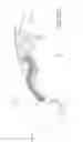 Fig. 05 - Multiple spinal surgical pathways systems and methods