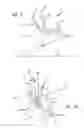 Fig. 12 - Multiple spinal surgical pathways systems and methods