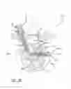 Fig. 15 - Multiple spinal surgical pathways systems and methods