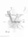 Fig. 17 - Multiple spinal surgical pathways systems and methods