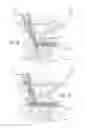 Fig. 19 - Multiple spinal surgical pathways systems and methods