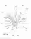 Fig. 31 - Multiple spinal surgical pathways systems and methods