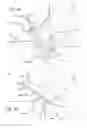 Fig. 35 - Multiple spinal surgical pathways systems and methods