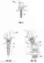 Fig. 04 - Minimally open interbody access retraction device and surgical method