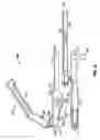 Fig. 17 - Minimally open interbody access retraction device and surgical method