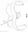 Fig. 22 - Minimally open interbody access retraction device and surgical method