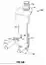 Fig. 28 - Minimally open interbody access retraction device and surgical method