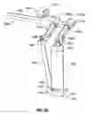 Fig. 45 - Minimally open interbody access retraction device and surgical method