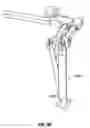 Fig. 46 - Minimally open interbody access retraction device and surgical method
