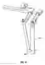 Fig. 47 - Minimally open interbody access retraction device and surgical method
