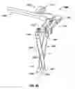 Fig. 48 - Minimally open interbody access retraction device and surgical method