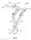Fig. 49 - Minimally open interbody access retraction device and surgical method