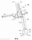 Fig. 51 - Minimally open interbody access retraction device and surgical method