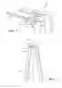Fig. 02 - Soft tissue retractor