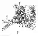 Fig. 12 - Surgical retractor system