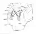 Fig. 01 - TISSUE AUGMENTATION TACKS FOR USE WITH SOFT TISSUE FIXATION REPAIR SYSTEMS AND METHODS